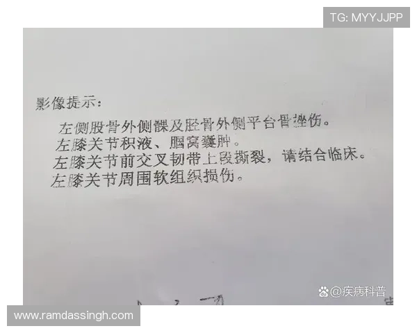 罗德里戈十字韧带部分撕裂保守治疗 罗德里戈十字韧带部分撕裂保守治疗